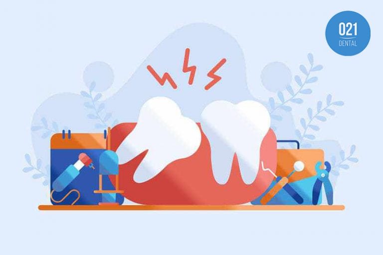 Guia dental sobre o dente do siso