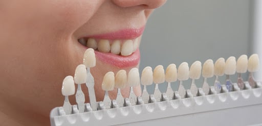 clareamento dental