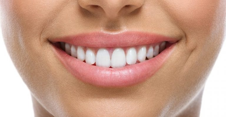 clareamento dental