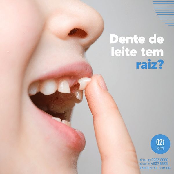 Dente de Leite tem Raiz
