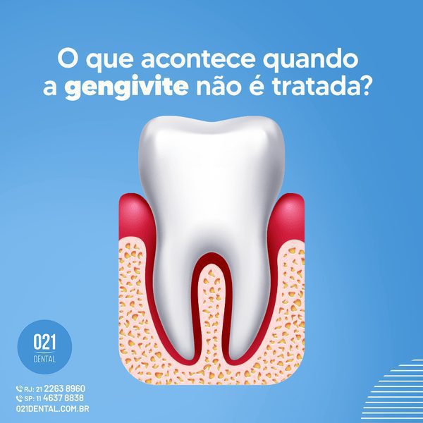 gengivite nao tratada