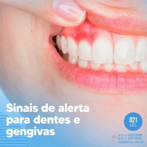 Sinais de Alerta para Dentes e Gengivas