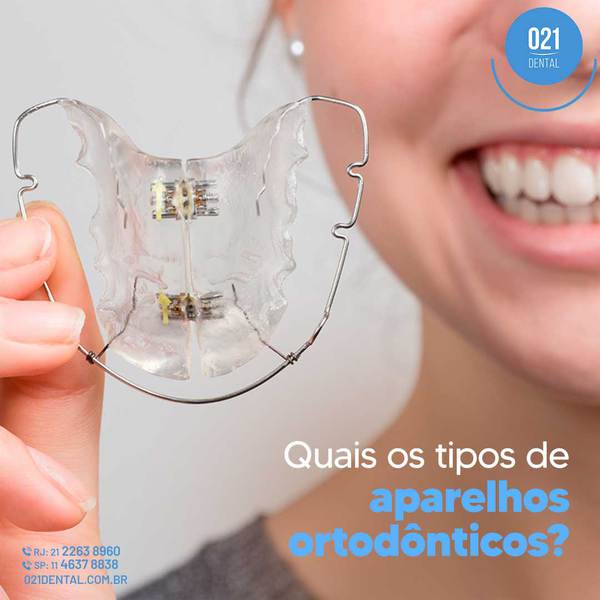 tipos de aparelhos ortodônticos