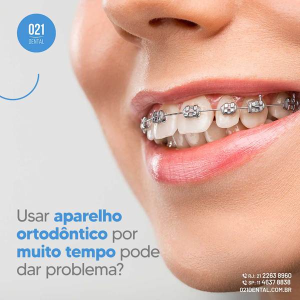 Usar aparelho ortodôntico por muito tempo pode dar problema