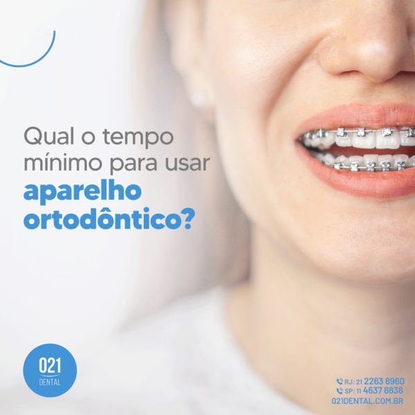 tempo mínimo para usar aparelho ortodôntico