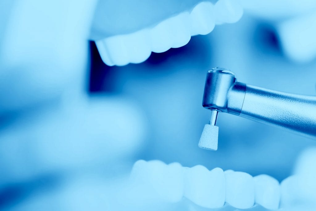 Limpeza dental no dentista