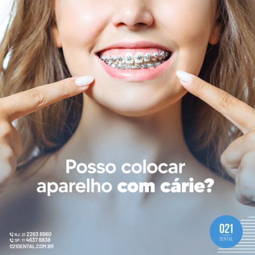 Posso colocar aparelho com cárie (1)