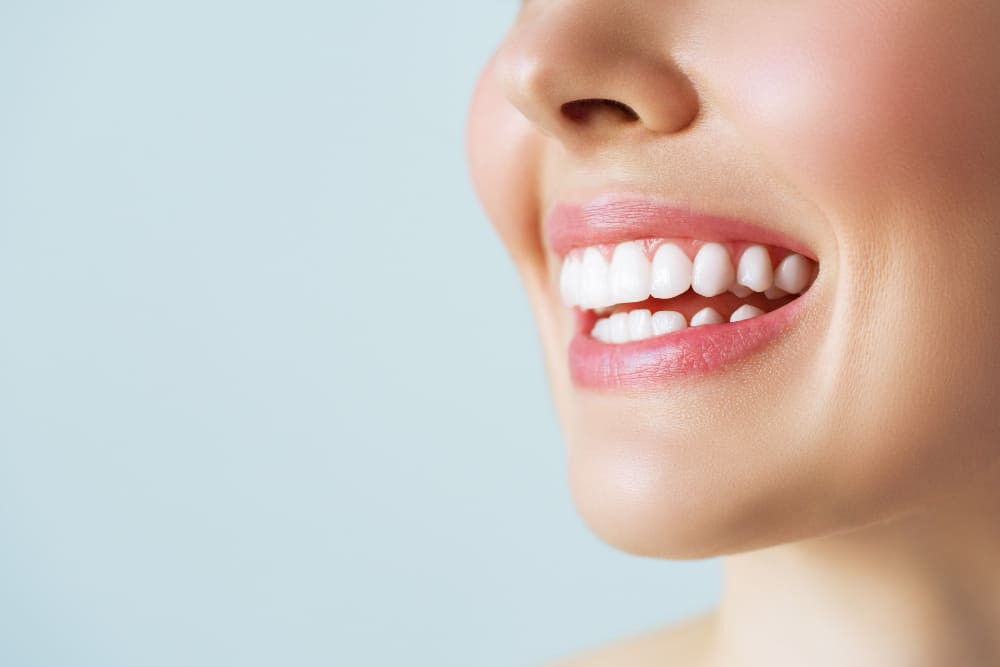 lentes de contato dental