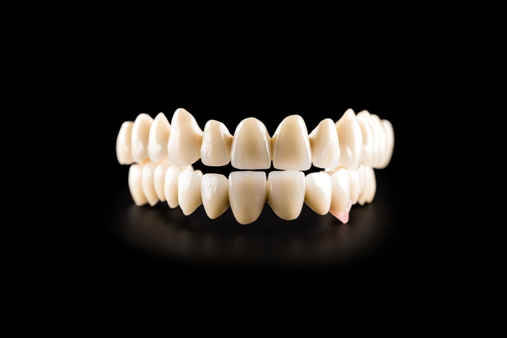 ponte fixa em porcelana