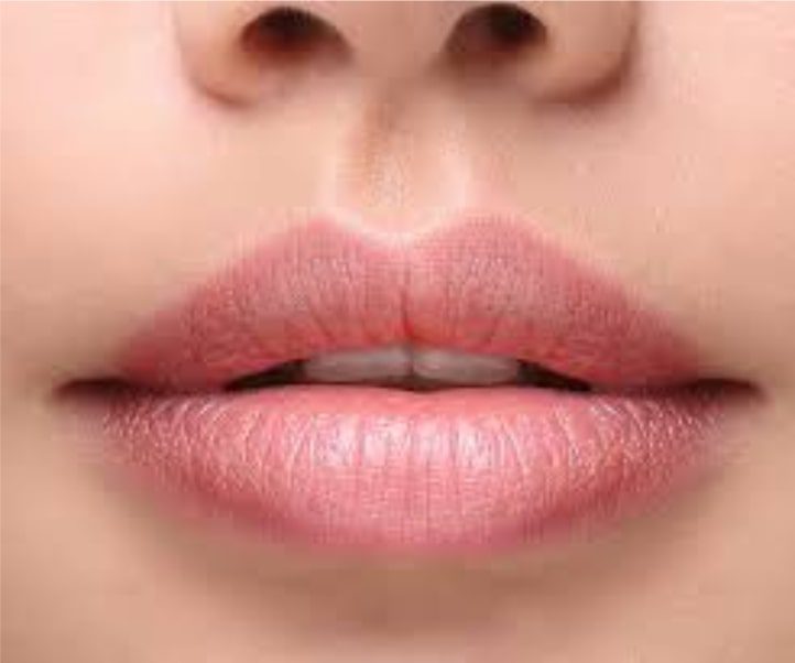 preenchimento labial