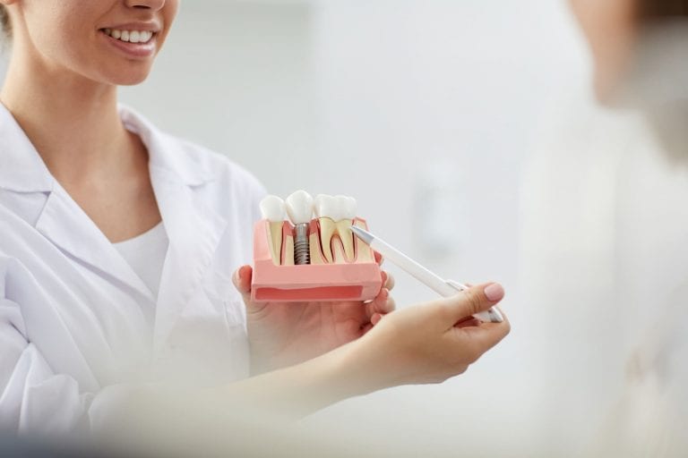 Como é o implante dentário
