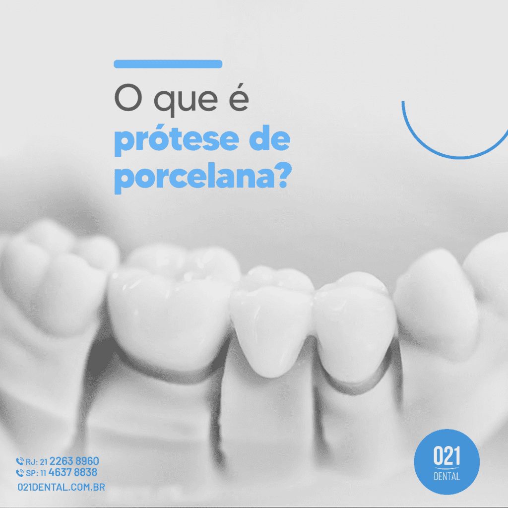 O que é prótese de porcelana (1)