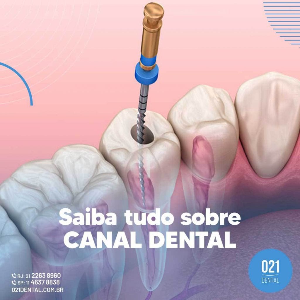 Saiba tudo sobre Canal dental