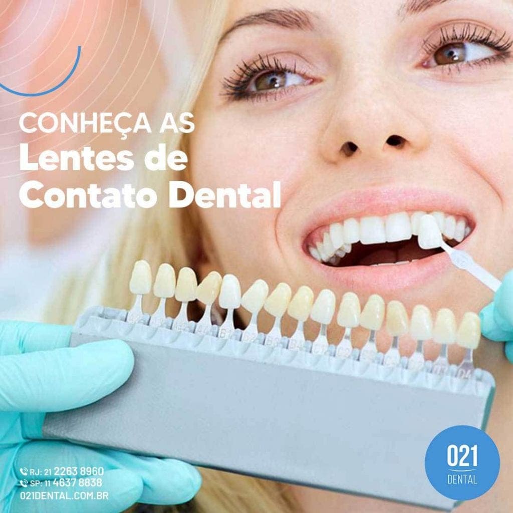 Para que servem as lentes de contato dental