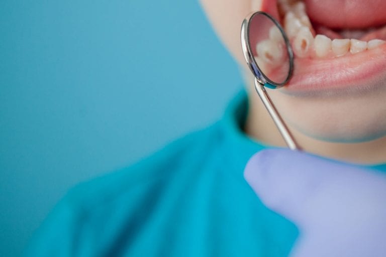 Quais são os sintomas da cárie dental