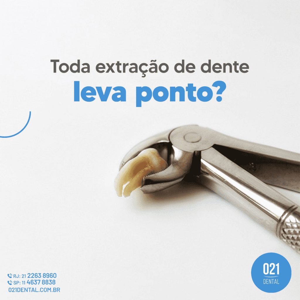 Toda extração de dente leva ponto (1)