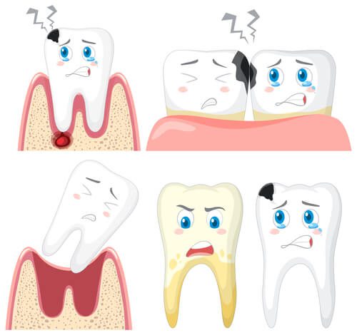 Tratamentos para dentes quebrando