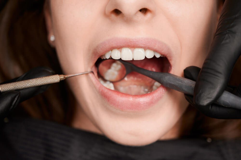 Paciente realizando procedimento de restauração em um dentista