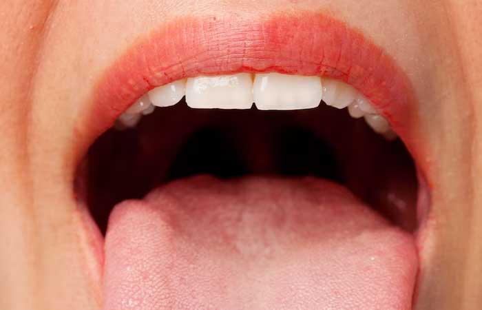 Boca Seca 5 Mitos e verdades que você deveria conhecer
