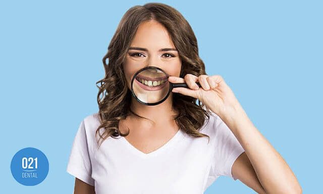Mulher com diastema nos dentes superiores frontais