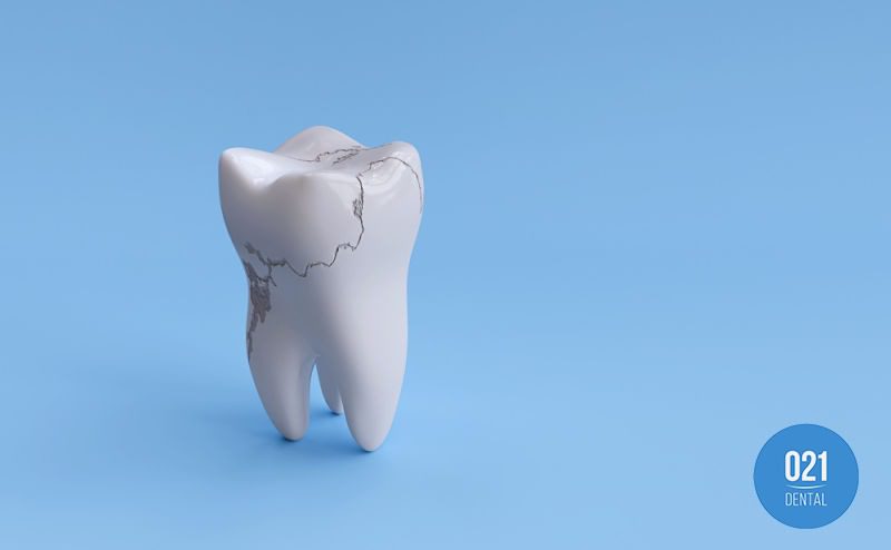 ilustração de dente com infiltração