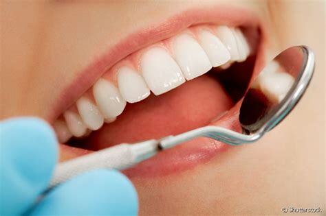 O que fazer quando a restauração do dente cai