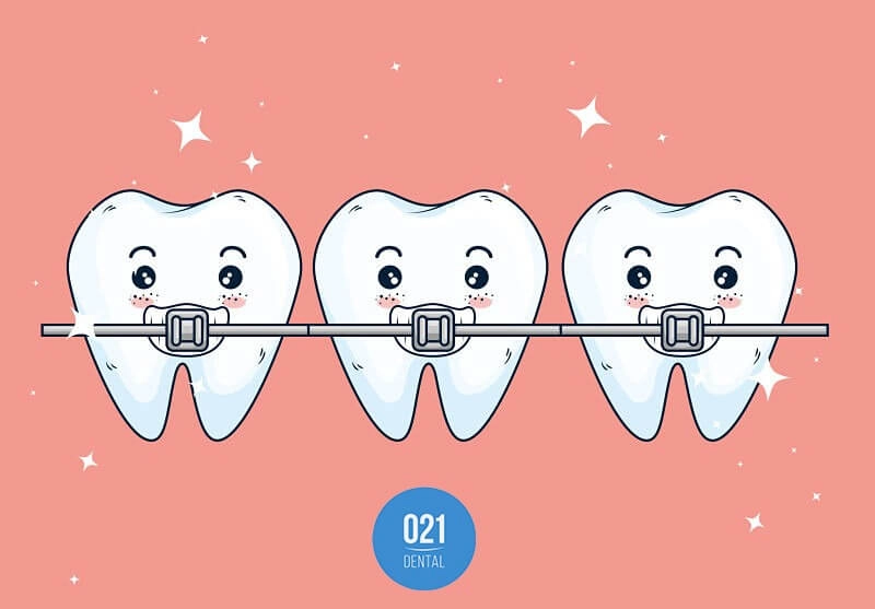Desenho de três dentes com aparelho ortodontico