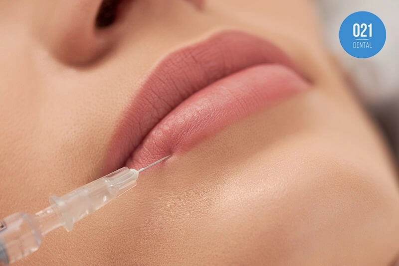 Imagem de uma mulher fazendo preenchimento labial