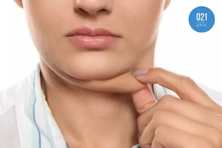 imagem de uma mulher puxando sua papada