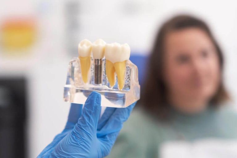 Quanto custa um implante dentário A BRdental te conta!