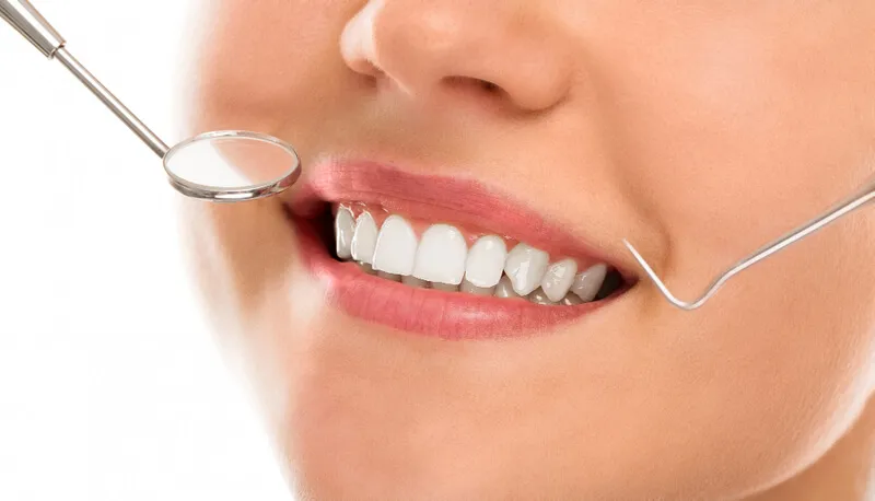Aparelhos ortodônticos em frente a uma mulher sorrindo