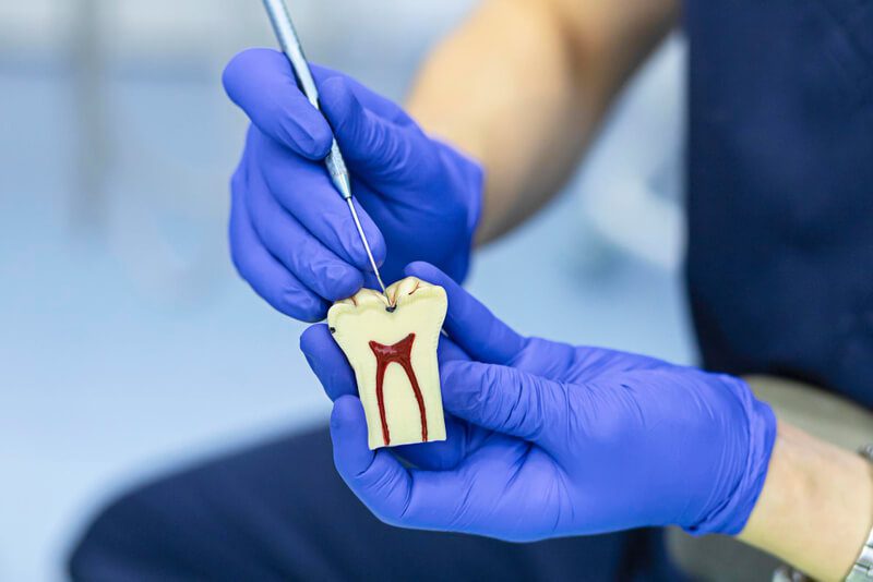 O que é a endodontia