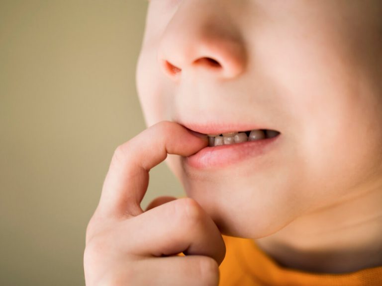 Bruxismo Infantil O Guia Definitivo para Pais e Cuidadores