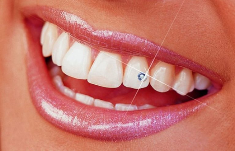 piercing dente