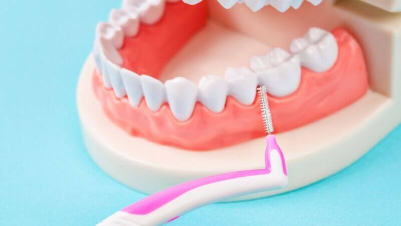 O que é a Escova Interdental