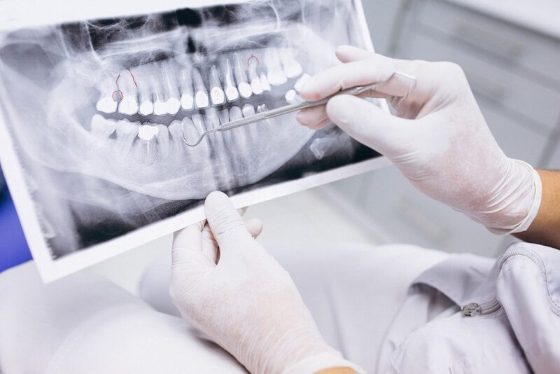 Anatomia da Mandíbula em Detalhes