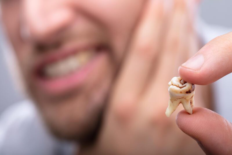 O que é a cárie no dente