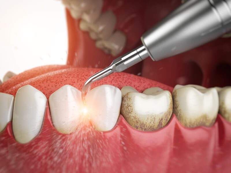 O que é periodontia