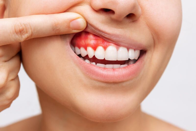 Quais são as áreas da periodontia