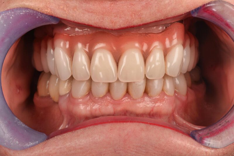 12 dicas de como manter sua arcada dentária saudável