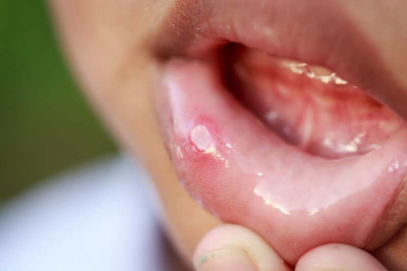 Mudanças Hormonais
