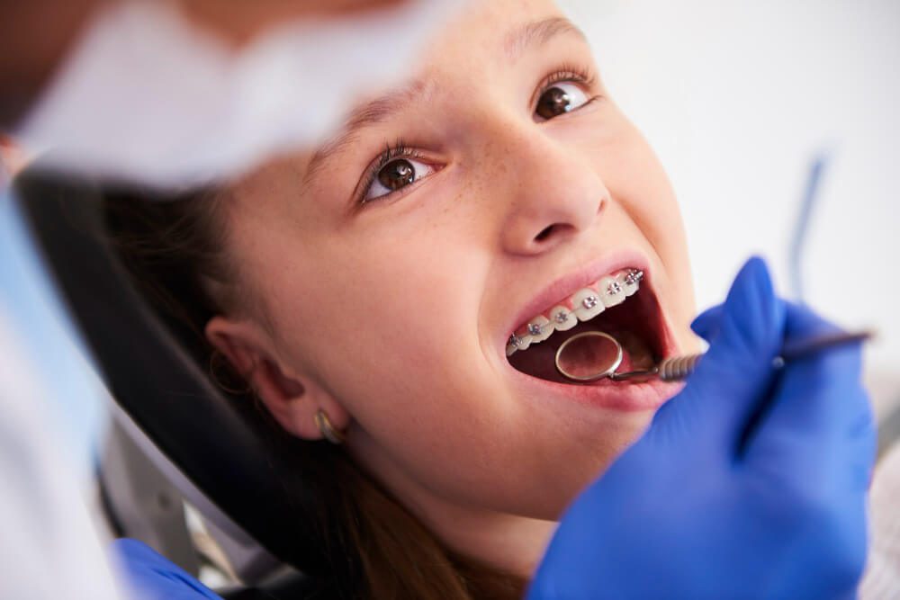 Aparelho dentário e ortodontia2