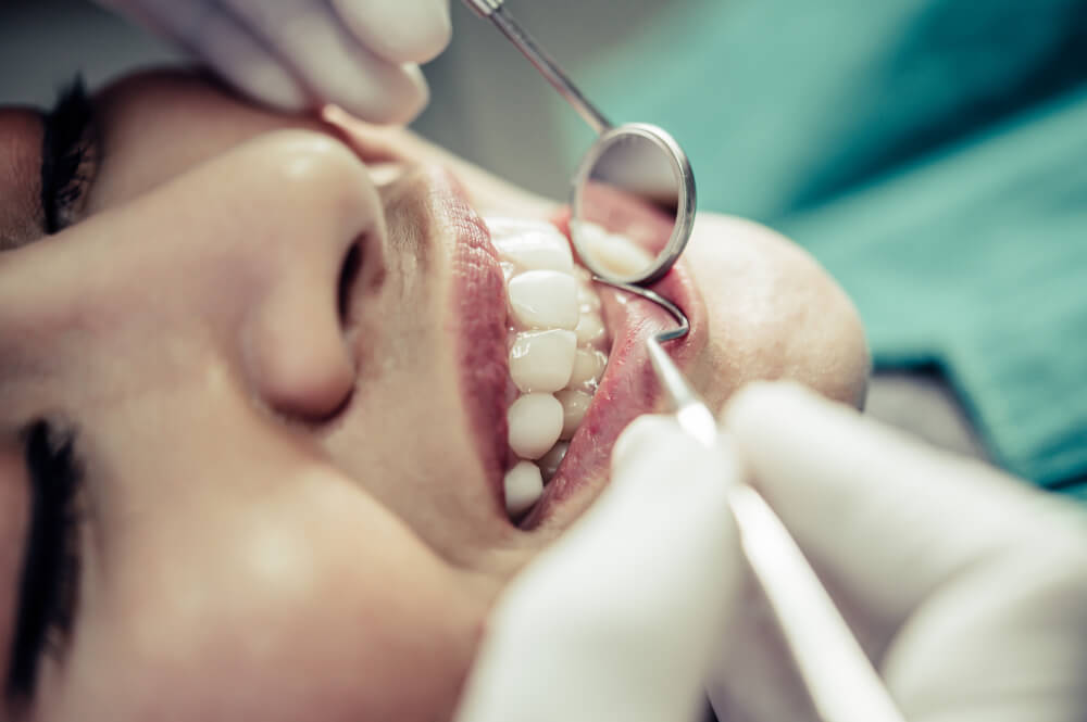 Extração Dentária e Cirurgia de Siso 2