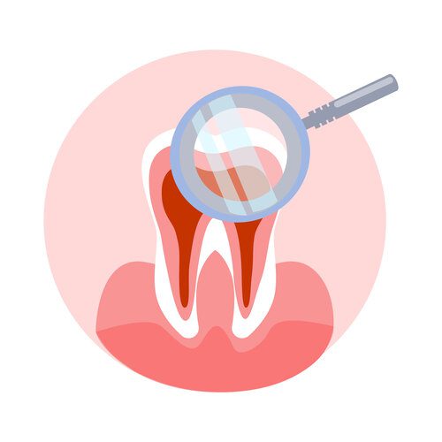 Extração Dentária