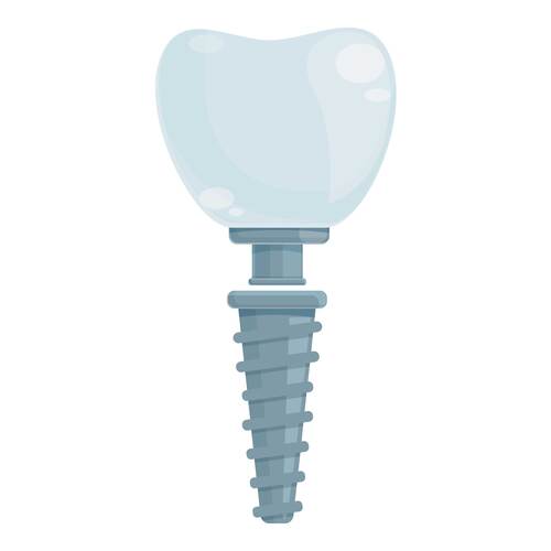 Implante Dentário