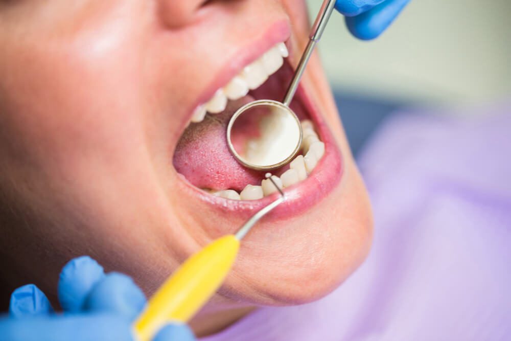 Restauração Dentária (2)