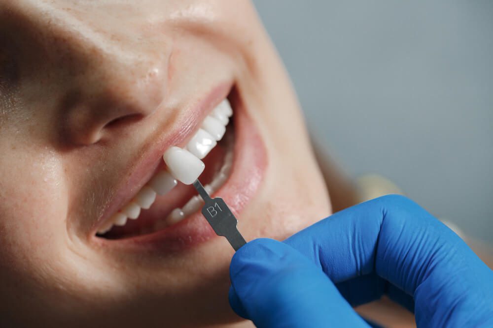 Restauração Dentária